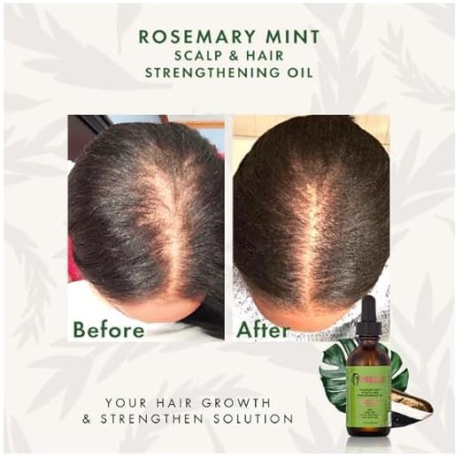Mielle Natural Rosemary Essential Oil For Hair Growth & Strengthening Oil 59 ML - Image 4